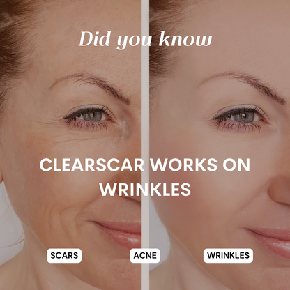ClearScar 2 Pack Silicone Gel Sheeting